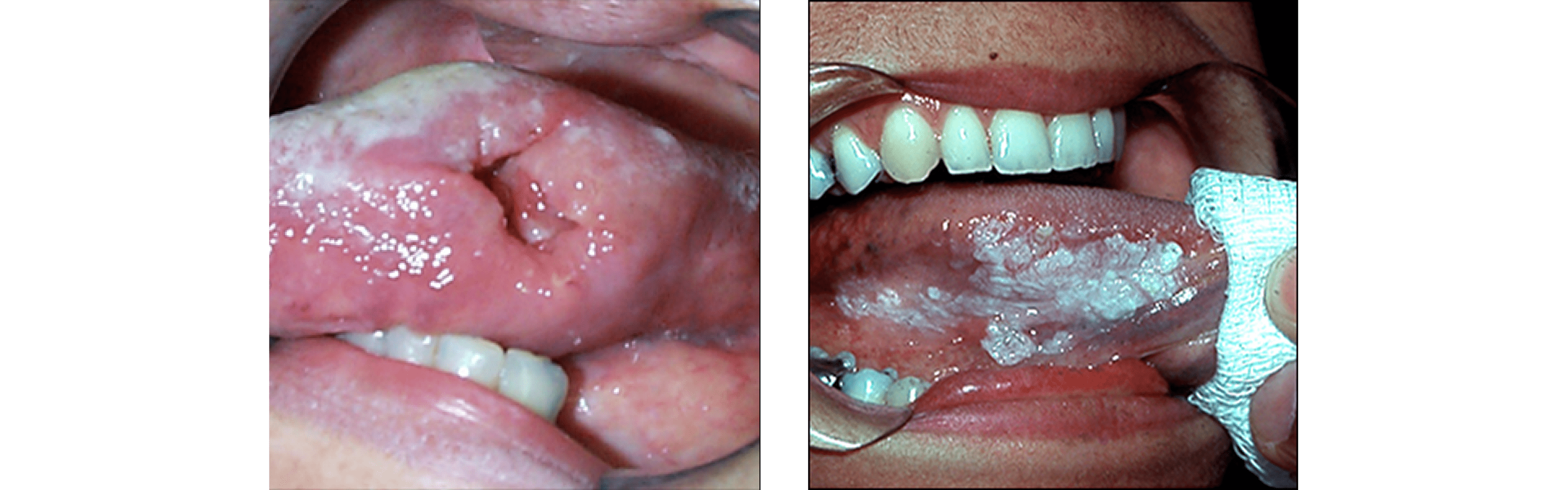 Oral Pathology Oral Pathology